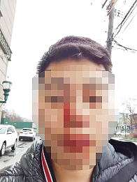 闽籍华男在史岛送货，因语言不通遭非裔店员暴打：鼻梁骨折、颅内出血；全家顶梁柱崩塌（组图） - 1