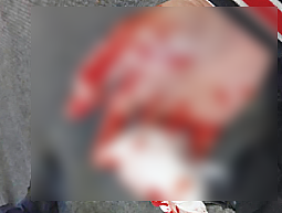 闽籍华男在史岛送货，因语言不通遭非裔店员暴打：鼻梁骨折、颅内出血；全家顶梁柱崩塌（组图） - 2