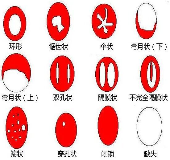 【两性】第一次！那是一个夜黑风高的夜晚...他没准备润滑油（组图） - 1