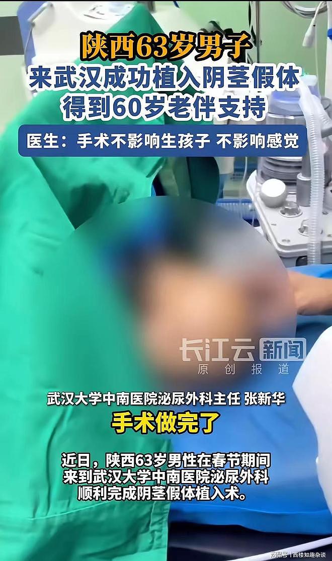 63岁的男子到武汉成功植入了17.5公分的阴茎假体,妻子很支持(视频/图) - 1