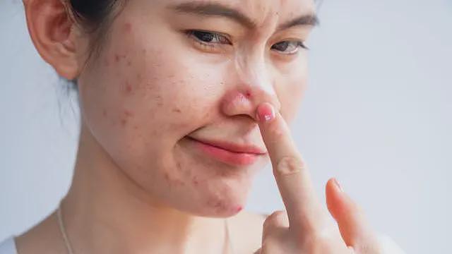 压力对皮肤有什么影响——以及你能怎么做（组图） - 4