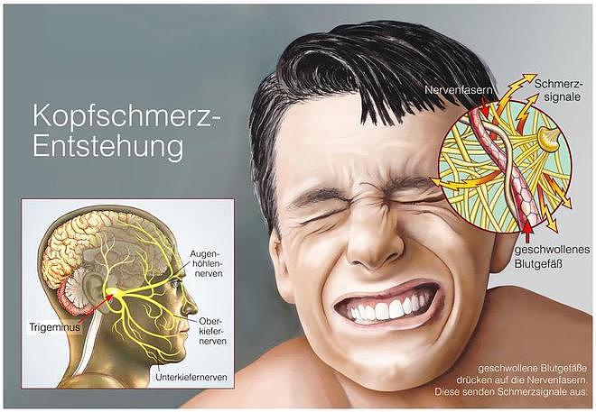 世界上最疼的病是什么病？疼痛排名前6的病，经历过的都是超人（组图） - 8