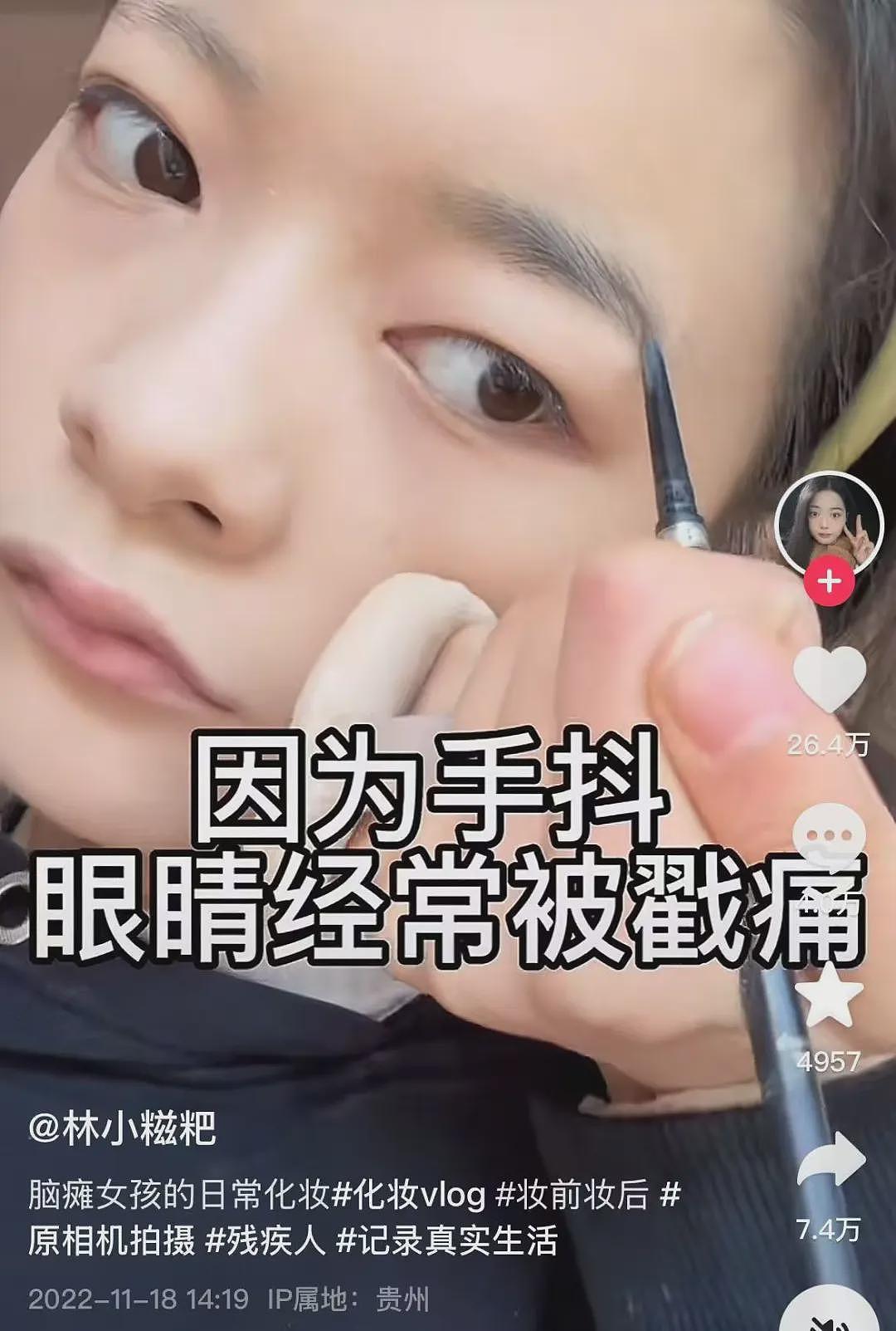 【情感】00后脑瘫女孩做美妆博主,帮家里还债40余万,网友:她好美,像天使(组图) - 2