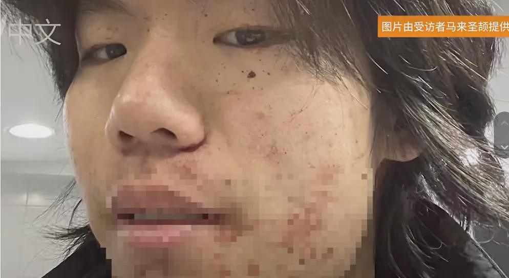 “中国孩子都是强奸犯!”墨尔本妈妈带娃坐公交,竟遭疯狂辱骂!中国留学生挺身而出,结果让人心寒…(组图) - 12