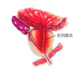 【两性】18禁：我自慰，算有性生活嘛（组图） - 10