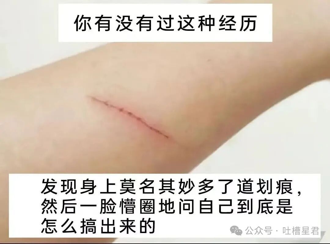 【爆笑】“关于我身上挂着内衣骑行1.5公里这件事…?”哈哈哈人怎么能尴尬成这样!(组图) - 44