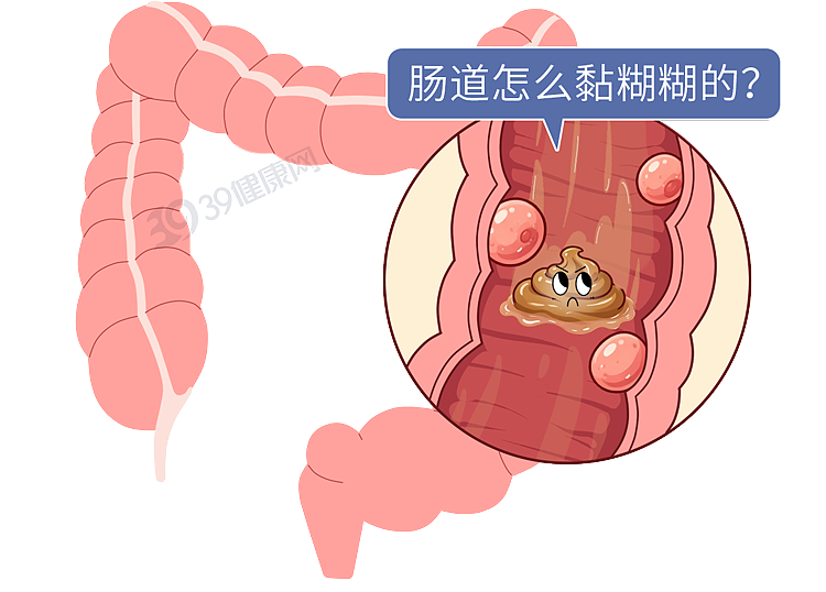 体内有癌,大便先知?若粪便出现3种异常,当心肠癌预警(组图) - 9