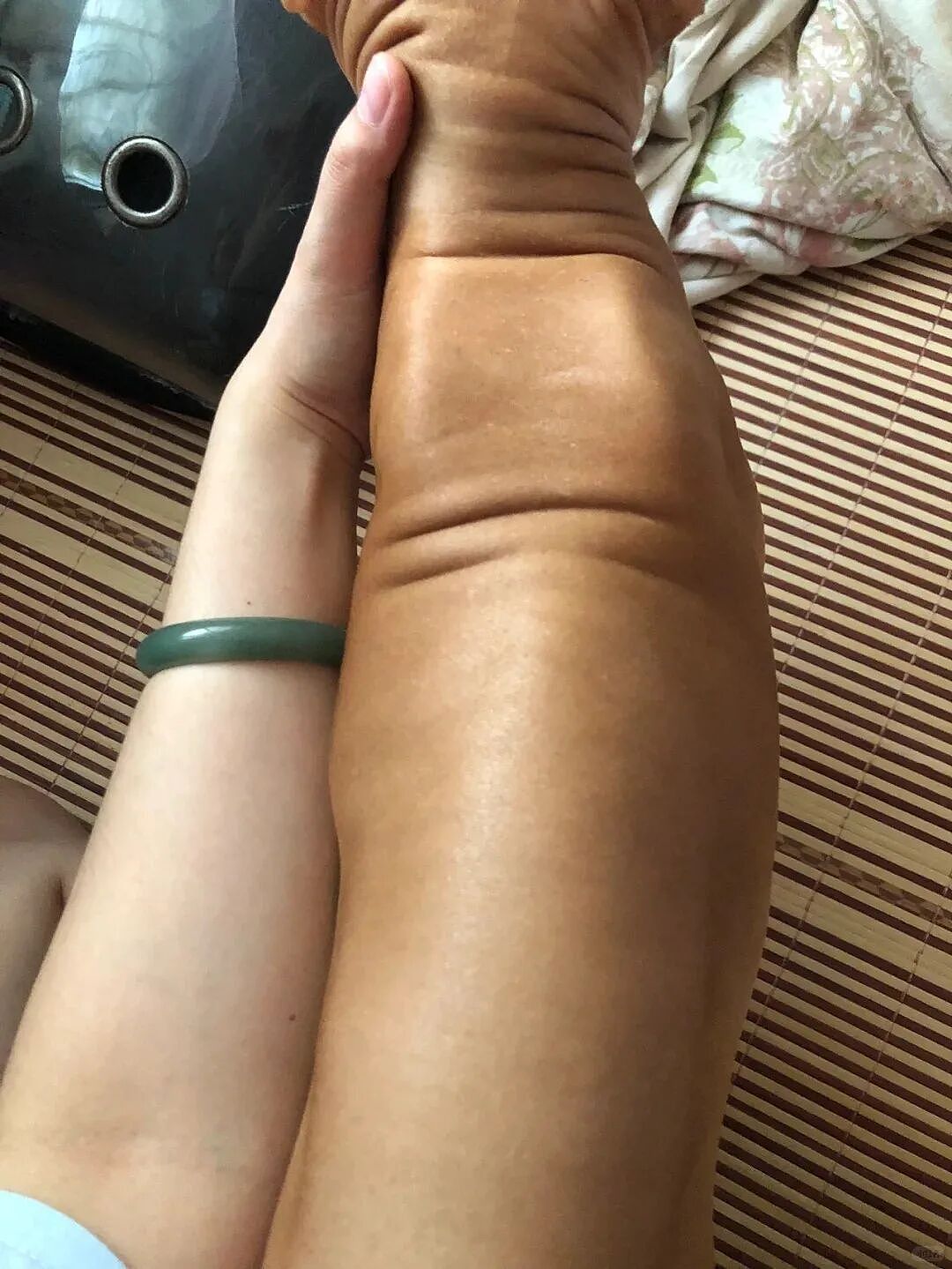 【宠物】小姐姐旅游半个月,回家发现无毛猫变色了,急得发帖求助,网友一看图就破案...(组图) - 6