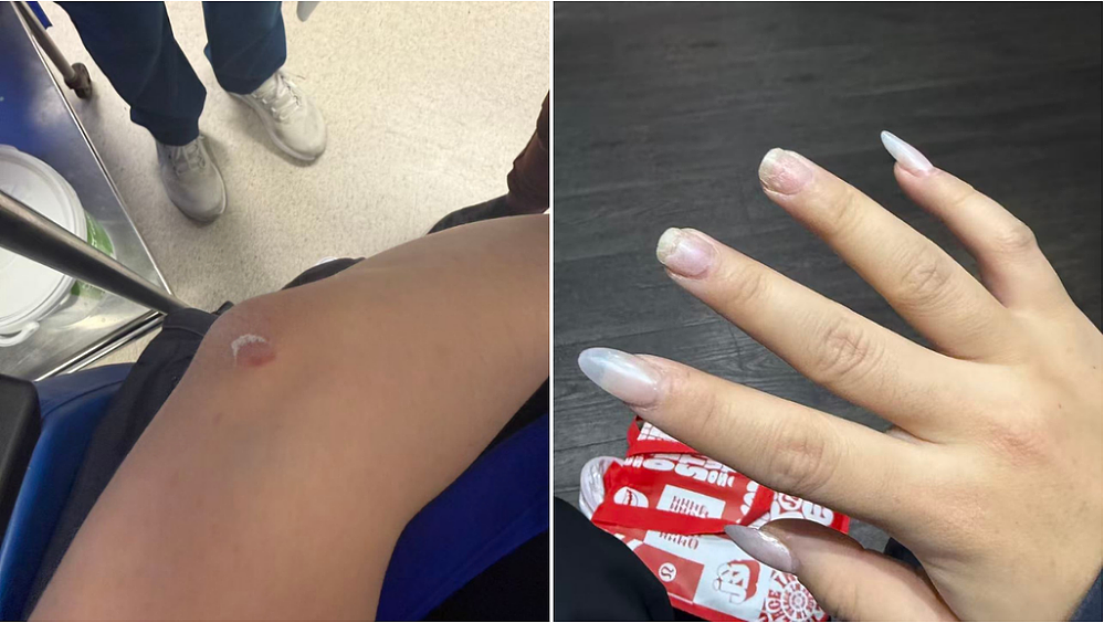 突发！23岁中国女留学生在悉尼街头遭teenager当街暴打，脑震荡+ PTSD，打人者至今没抓到！（组图） - 4