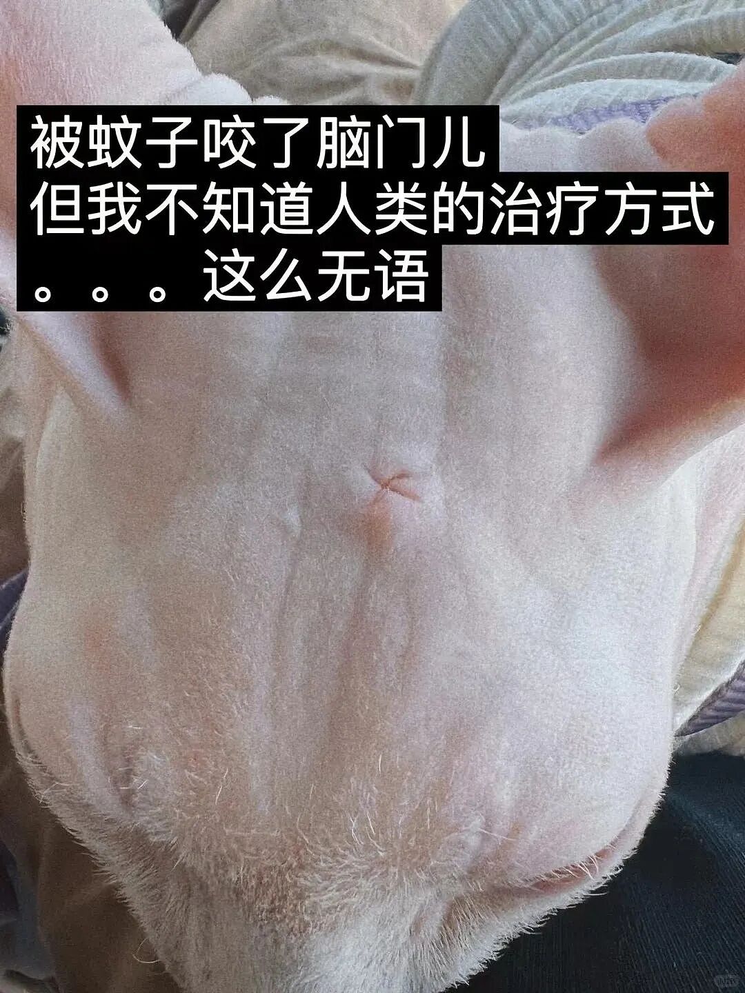 【宠物】养猫不能点蚊香，猫被蚊子追着咬，人也被咬，好气啊啊啊啊啊啊啊啊啊！（组图） - 6