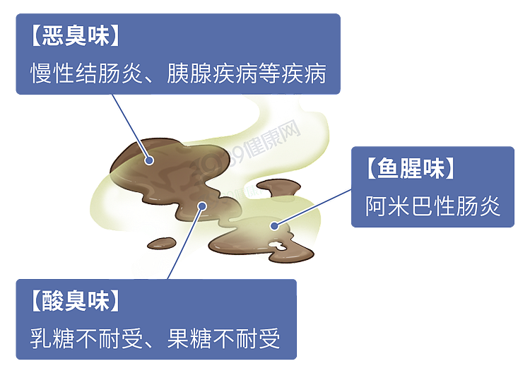 【健康】疾病来临,大便先知?拉屎出现3种异味,当心大病信号(组图) - 8
