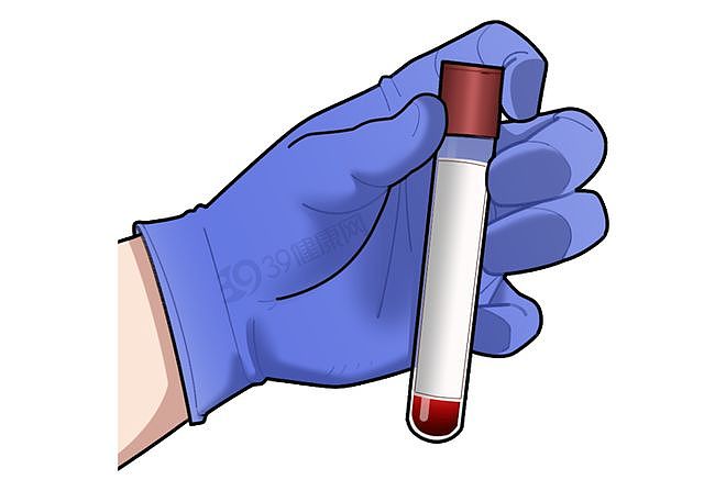 52岁男子总怀疑妻子偷吃,一查竟是晚期梅毒!身体3种异常要当心(组图) - 14