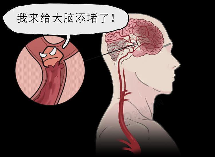 【健康】你爱用的这种枕头,正悄悄堵住脑血管!家里有的赶紧换 - 4