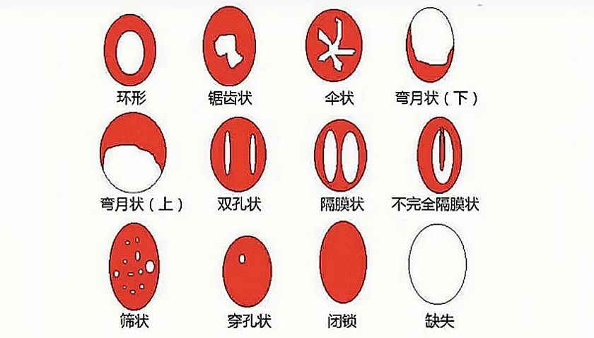 【两性】“鼓掌” 能减肥？尺寸越大越好？这些两性羞羞冷知识，看完脸都红了…（组图） - 3