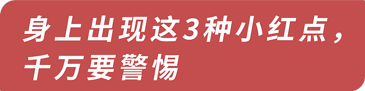 【健康】皮肤上长这种小疙瘩，是怎么回事？或暗示3种疾病，千万别大意（组图） - 7