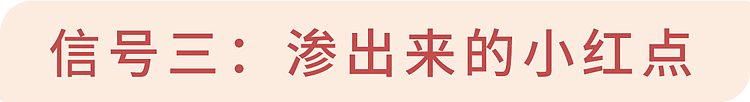 【健康】皮肤上长这种小疙瘩，是怎么回事？或暗示3种疾病，千万别大意（组图） - 13