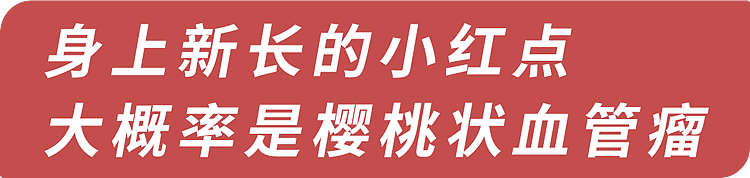 【健康】皮肤上长这种小疙瘩，是怎么回事？或暗示3种疾病，千万别大意（组图） - 16