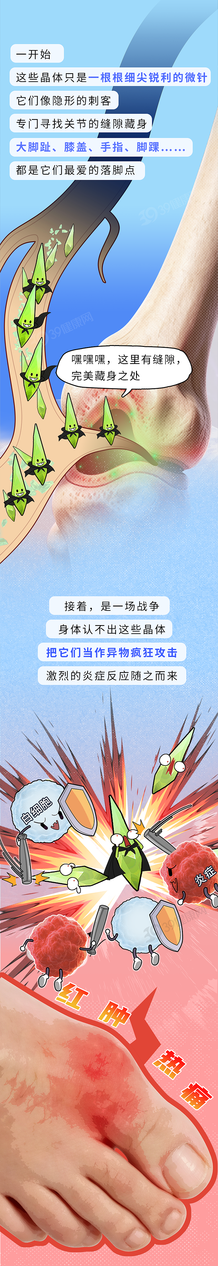 【健康】以为痛风只是脚趾痛?当心关节长满“石头”,彻底报废!(组图) - 2