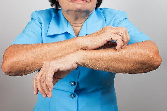 【健康】每吃一次，肾坏死就快一步？提醒：4种食物是肾坏死的“加速器”（组图） - 5