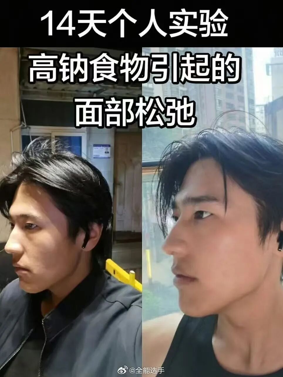 【爆笑】“女儿没做过的医美60岁老爸先做上了…？”哈哈哈做完瞬间解锁善良人格！（组图） - 39
