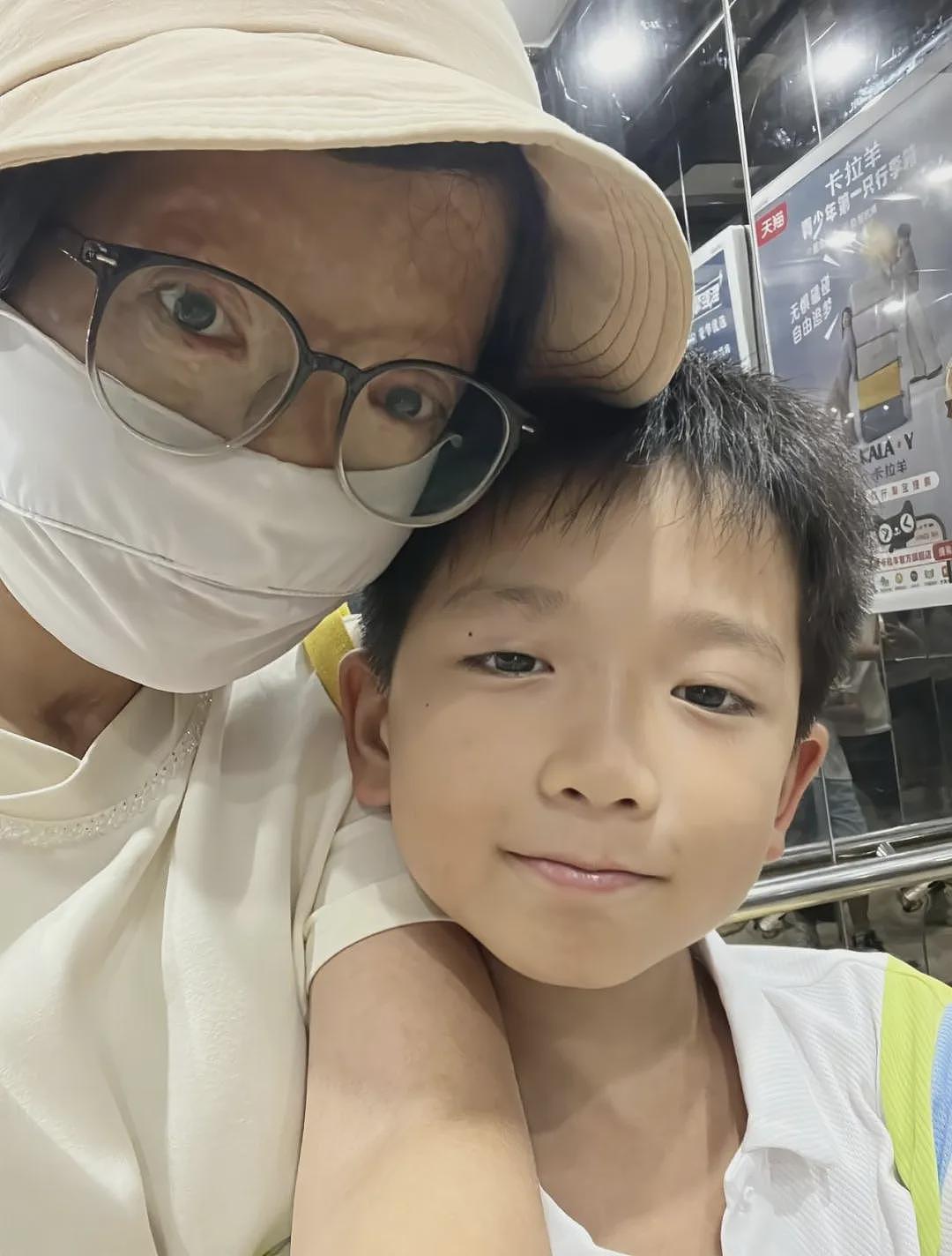 【情感】女主持烧伤毁容，离婚后收废品养家，8岁儿子操场大方喊话：有水瓶纸箱请留给我妈妈！ - 4