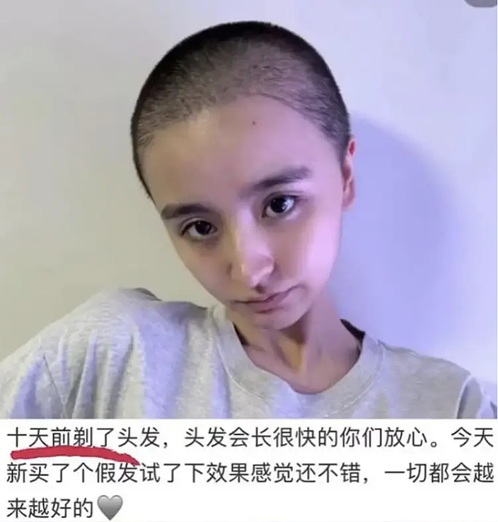 黄晓明、蔡依林、Taylor Swift全在列,曾自述右耳失聪、被注射不明液体!退圈女星点名半个娱乐圈(组图) - 3