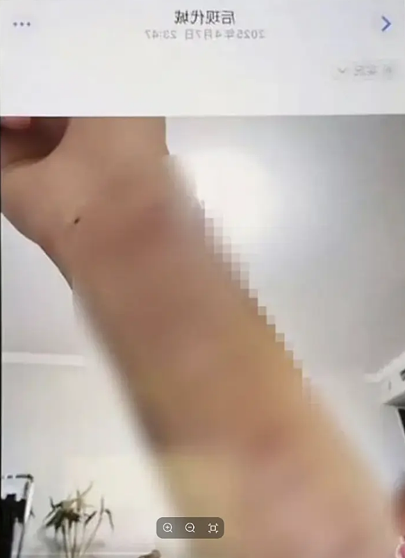 黄晓明、蔡依林、Taylor Swift全在列,曾自述右耳失聪、被注射不明液体!退圈女星点名半个娱乐圈(组图) - 5