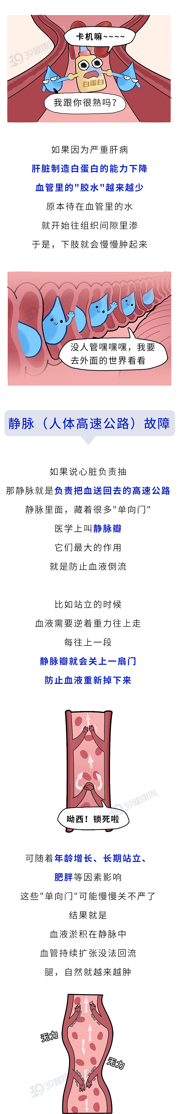 穿袜子总有勒痕?千万别大意,或是4种严重疾病的信号(组图) - 5