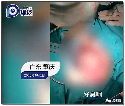 14岁男孩网购假YJ塞GM后整体滑入拿不出来!青少年X教育热议 - 39
