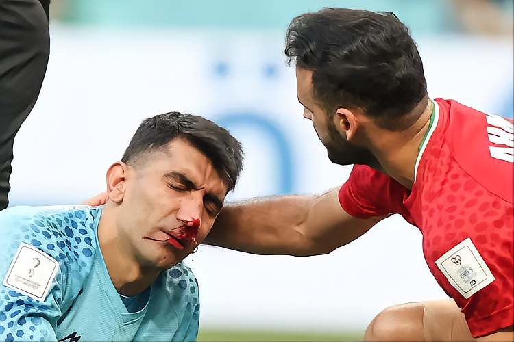 世界杯上的伤病：贝兰万德血洒赛场，保护鼻子有多重要（组图） - 1