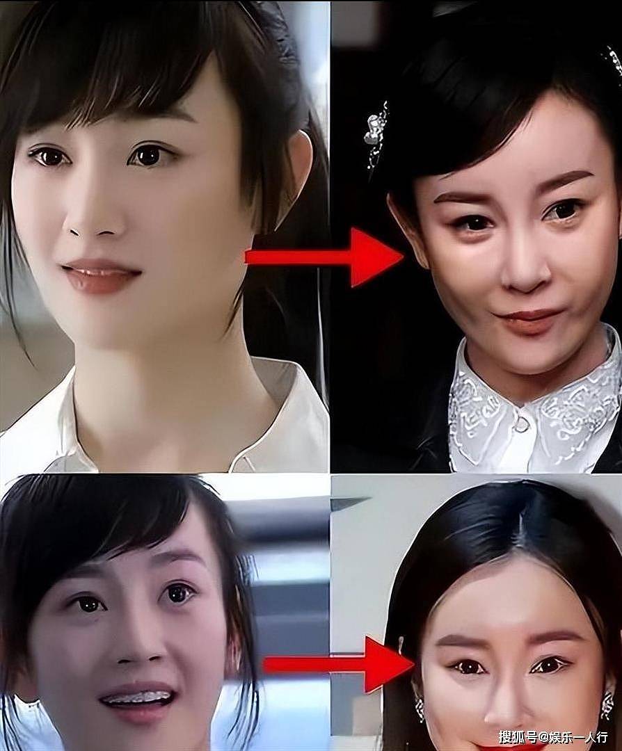 女演员切勿整容,白鹿〈莫离〉vs陈都灵〈翘楚〉,高清镜头把内娱遮羞布撕下来了 - 11