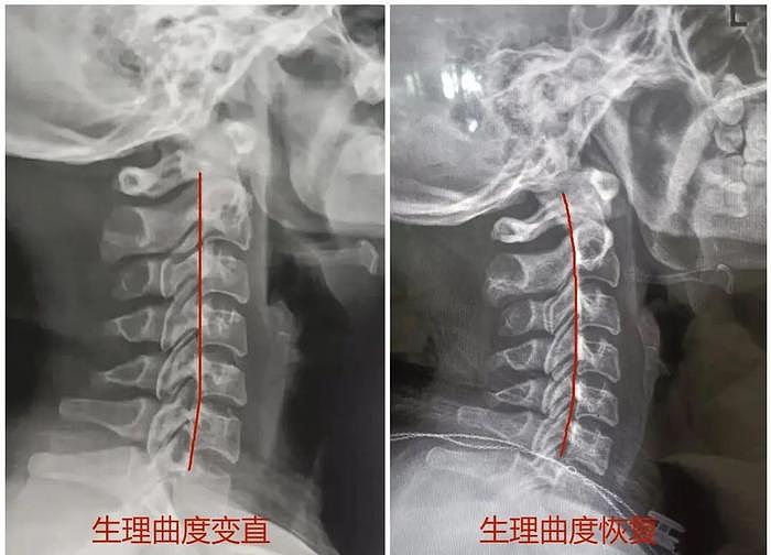 顶级神颜低谷期变胖20斤，居然还能迎来事业第二春？ - 30