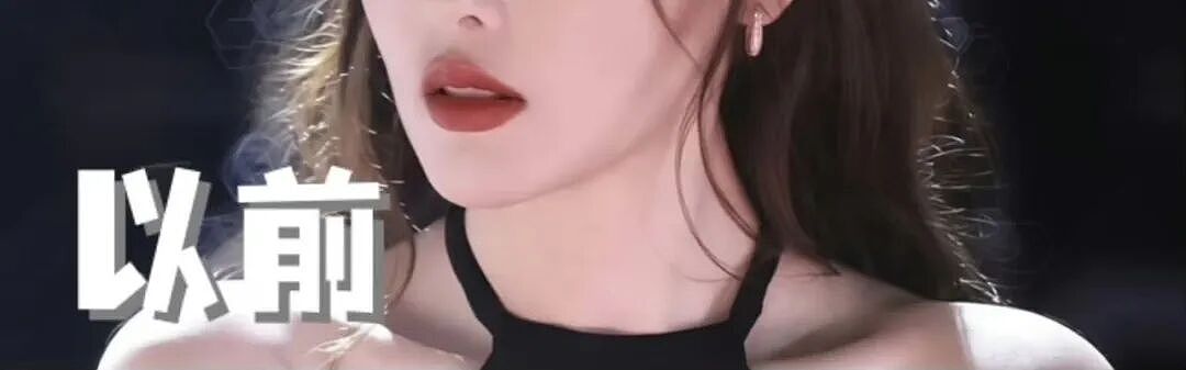 张天爱变样上热搜?先别骂,她这次可能真没动刀(组图) - 2