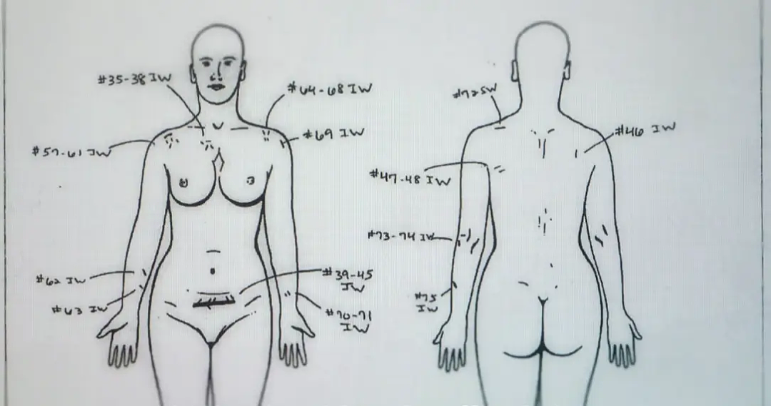 吓坏全美！女子假孕生娃被捕，孩子竟是她剖开孕妇闺蜜肚子偷的？ - 26