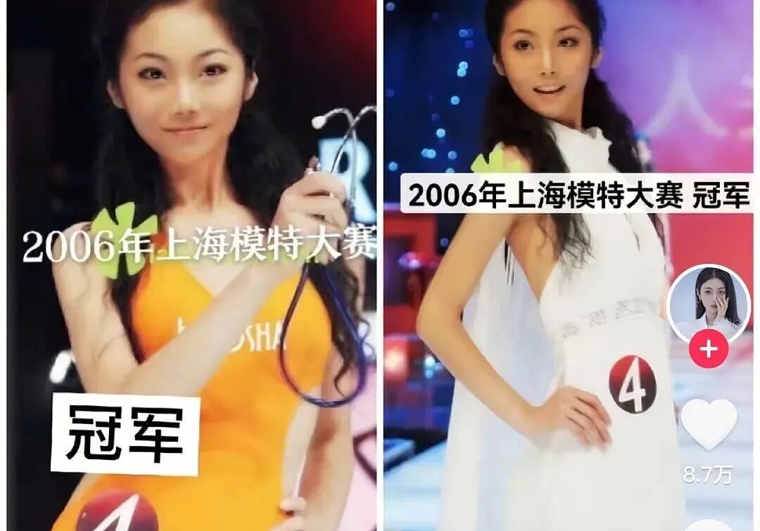 中国女子花50万买精，生下混血三胞胎！8年后3个娃长这样，惊艳全网（组图） - 5