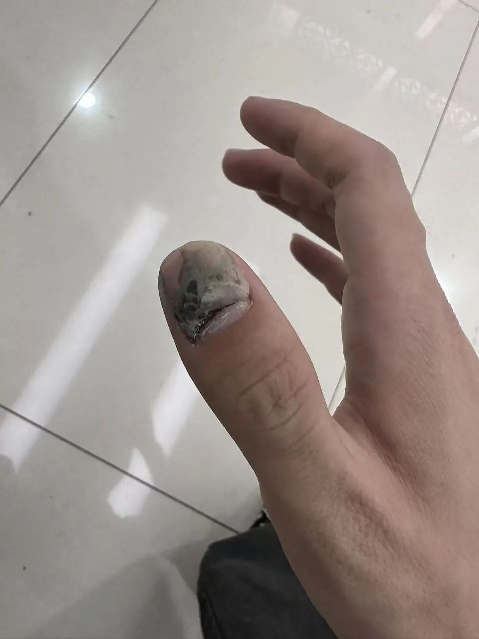 百万级豪车才有的电吸门普及后，却把人“夹怕了” - 2