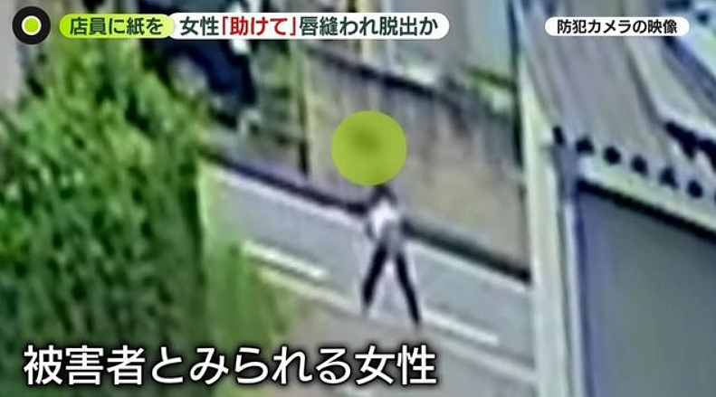 日本49岁女子虐待同居女性,将其嘴巴用针线缝死!被害女子举纸条求救! - 3