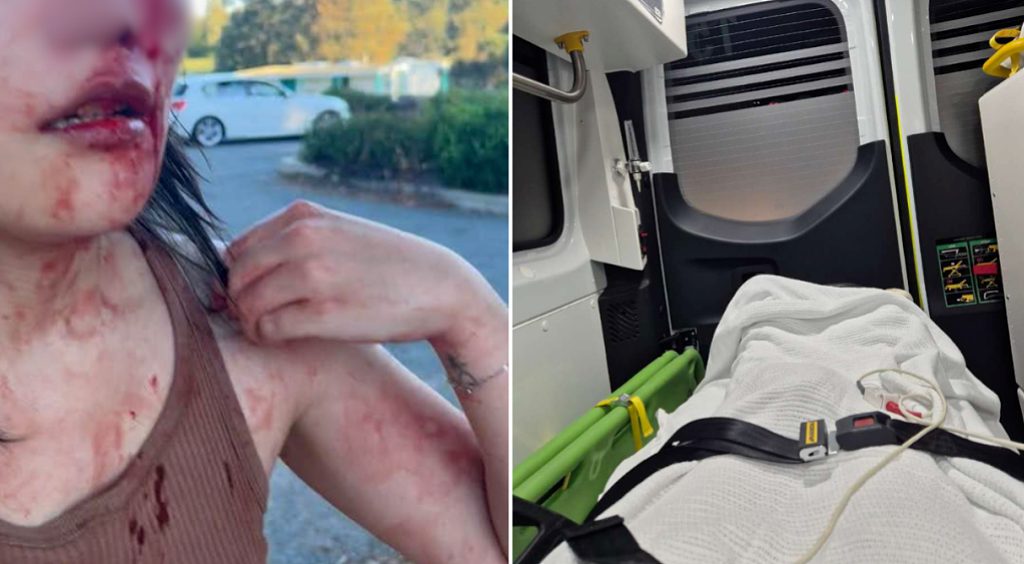 澳洲23岁华女市中心遭种族袭击，被两人殴打！“指甲断裂，脑震荡”（组图） - 10