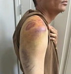 华裔男子遭休班警重击昏迷，醒来却被反控袭警（组图）