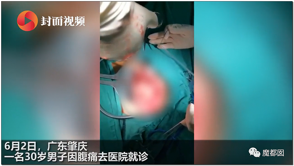 14岁男孩网购假YJ塞GM后整体滑入拿不出来!青少年X教育热议 - 38