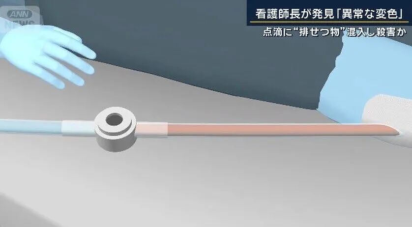 女护士往老人点滴里加大便?!两天后老人死了,她至今拒绝认罪 - 5