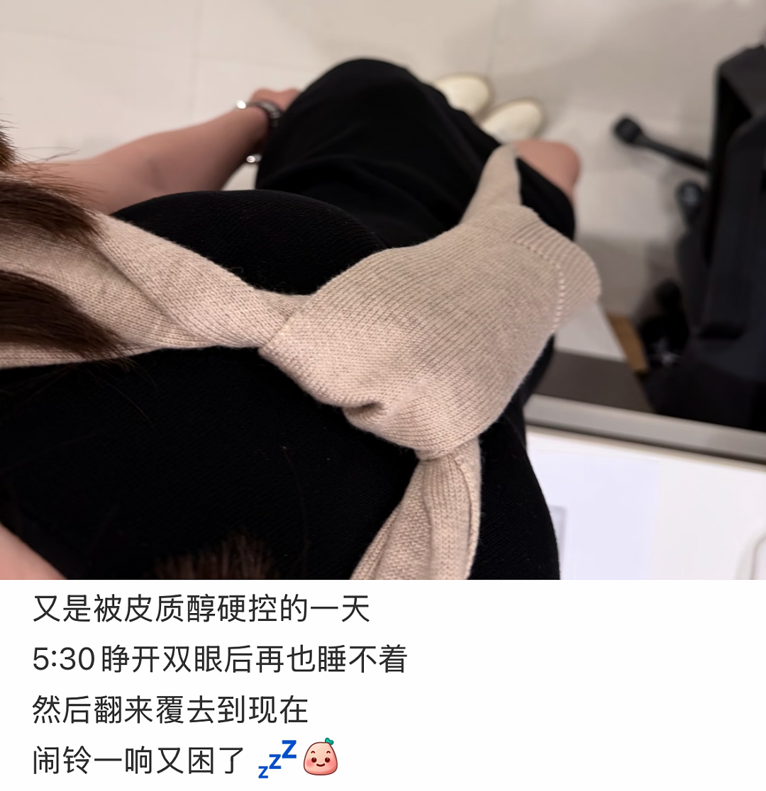 “不吃压力”成打工人新晋顶配人设,皮质醇到底该咋降(组图) - 6