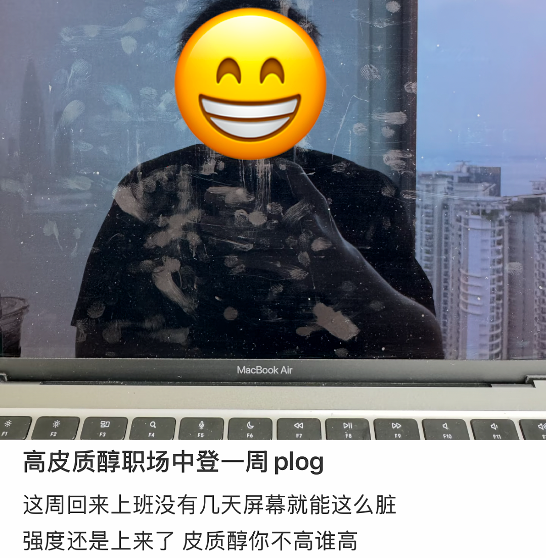 “不吃压力”成打工人新晋顶配人设,皮质醇到底该咋降(组图) - 2