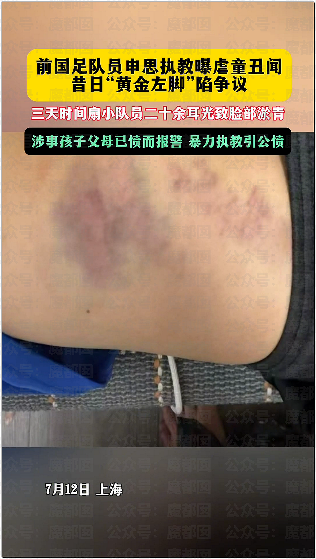 中国前国脚狠抽小球员20多记耳光,屁股打出淤青!家长报警(组图) - 21