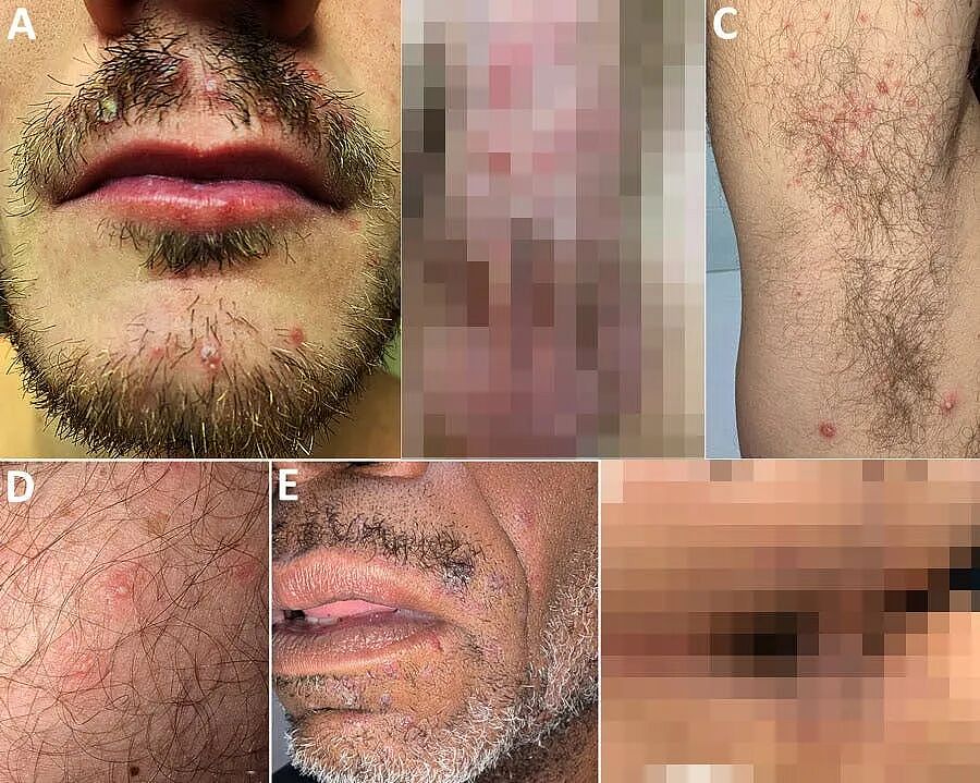里昂男同浴室养蛊?在桑拿房做不可描述之事,牛病变性病(组图) - 3