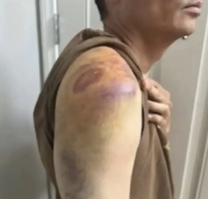 “中国杂碎！” 华男Costco遭种歧辱骂，被重摔失去知觉！险被做局坐冤狱（组图） - 3
