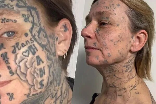 被迫纹身250次,90%皮肤成前任的“签名”,现在她只想洗白自己(组图) - 5
