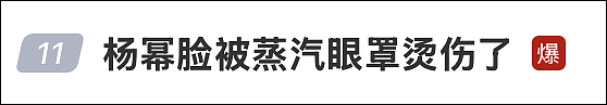 杨幂脸部遭烫伤!网友后怕:“我每次都是戴着睡觉,再也不敢了”(组图) - 1