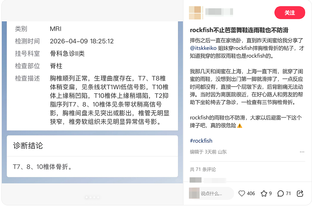 “鞋底堪比镜面、平地摔出骨折”，这网红芭蕾鞋费钱又“费人”（组图） - 4