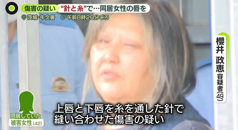 日本49岁女子虐待同居女性,将其嘴巴用针线缝死!被害女子举纸条求救! - 4